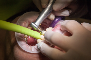 dentist, patient