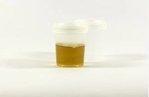 synthetic urine in a container